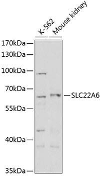 Western blot - SLC22A6 Polyclonal Antibody 
