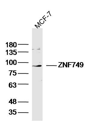 Fig2: Sample: MCF-7 Cell (Mouse) Lysate at 40 ug; Primary: Anti-ZNF749 at 1/300 dilution; Secondary: IRDye800CW Goat Anti-Rabbit IgG at 1/20000 dilution; Predicted band size: 90 kD; Observed band size: 90 kD