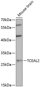 Western blot - TCEAL2 Polyclonal Antibody 