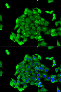 Immunofluorescence - RPS14 Polyclonal Antibody 