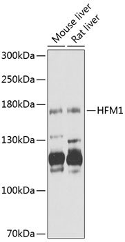 Western blot - HFM1 Polyclonal Antibody 