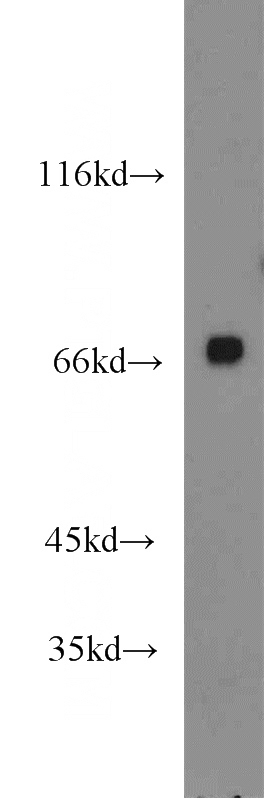 mouse testis tissue were subjected to SDS PAGE followed by western blot with Catalog No:110865(GAPDHS antibody) at dilution of 1:800