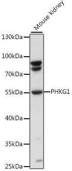 Western blot - PHKG1 Polyclonal Antibody 