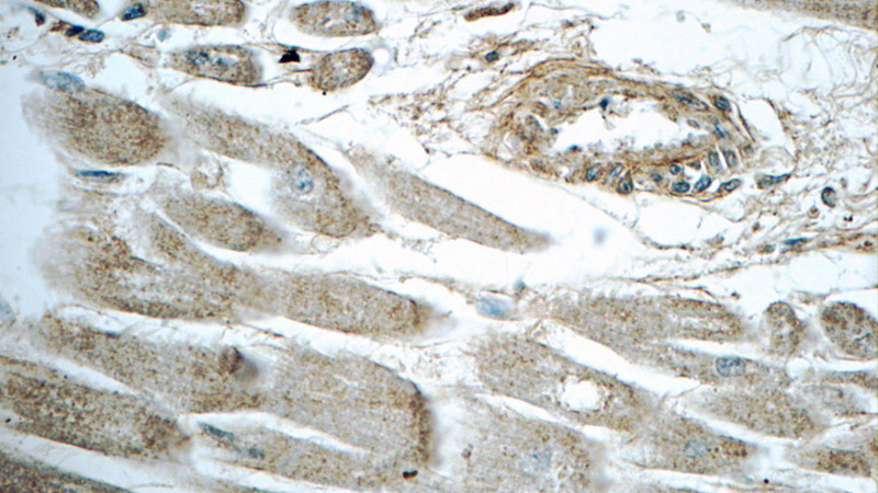 Immunohistochemistry of paraffin-embedded human heart tissue slide using Catalog No:112358(LTB4R Antibody) at dilution of 1:50 (under 40x lens)