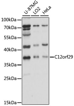 Western blot - C12orf29 Polyclonal Antibody 