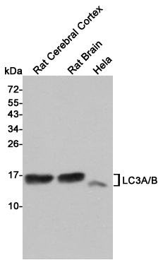 Western blot detection of LC3A/B in Rat Cerebral Cortex,Rat Brain and Hela cell  lysates using LC3A/B Mouse mAb (1:1000 diluted). Predicted band size: 15KDa. Observed band size:14, 16KDa.