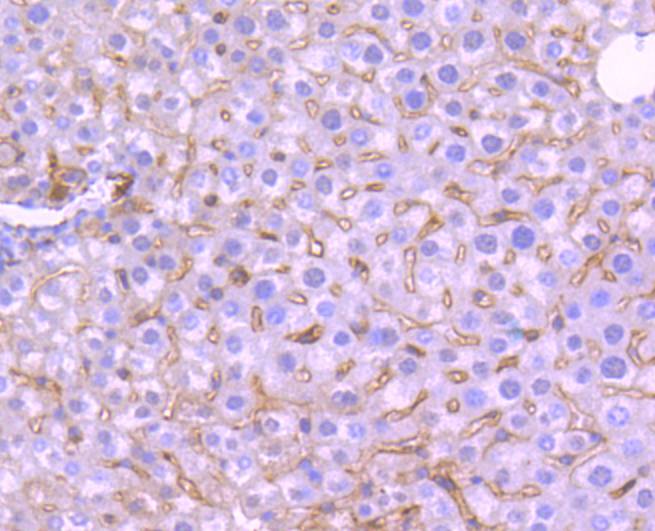 Fig7:; Immunohistochemical analysis of paraffin-embedded mouse liver tissue using anti-TrkA antibody. The section was pre-treated using heat mediated antigen retrieval with Tris-EDTA buffer (pH 9.0) for 20 minutes.The tissues were blocked in 1% BSA for 30 minutes at room temperature, washed with ddH; 2; O and PBS, and then probed with the primary antibody ( 1/50) for 30 minutes at room temperature. The detection was performed using an HRP conjugated compact polymer system. DAB was used as the chromogen. Tissues were counterstained with hematoxylin and mounted with DPX.