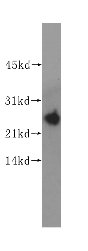 MCF7 cells were subjected to SDS PAGE followed by western blot with Catalog No:111369(hD53; TPD52L1 antibody) at dilution of 1:500