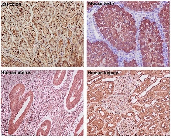 Immunohistochemical analysis of paraffin-embedded (1) Rat colon; (2) Mouse testis; (3) Human uterus; (4) Human kidney, using GAPDH Antibody .