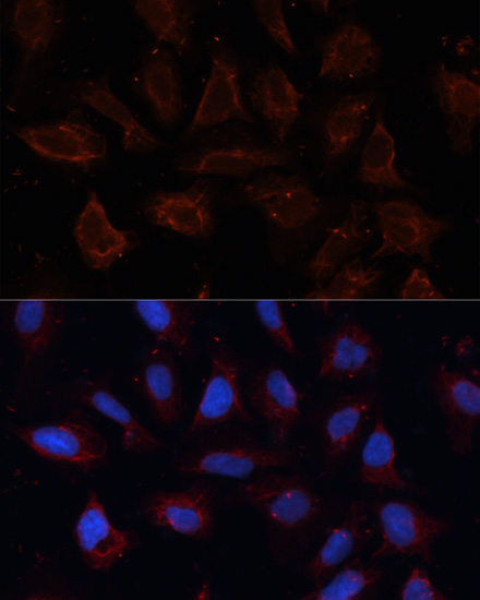 Immunofluorescence - ANO1 Polyclonal Antibody 