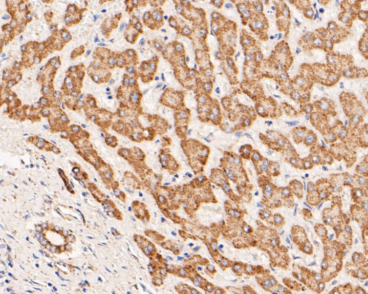 Fig5: Immunohistochemical analysis of paraffin-embedded human liver tissue using anti-ZAC antibody. The section was pre-treated using heat mediated antigen retrieval with Tris-EDTA buffer (pH 8.0-8.4) for 20 minutes.The tissues were blocked in 5% BSA for 30 minutes at room temperature, washed with ddH2O and PBS, and then probed with the primary antibody ( 1/200) for 30 minutes at room temperature. The detection was performed using an HRP conjugated compact polymer system. DAB was used as the chromogen. Tissues were counterstained with hematoxylin and mounted with DPX.