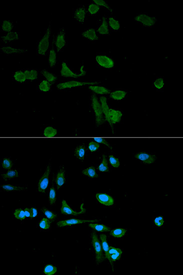 Immunofluorescence - SIRT7 Polyclonal Antibody 