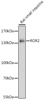 Western blot - ROR2 Polyclonal Antibody 