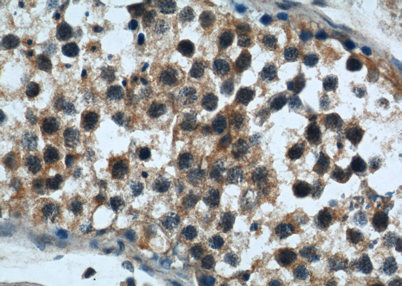 Immunohistochemical of paraffin-embedded human testis using Catalog No:114492(ZFYVE20 antibody) at dilution of 1:50 (under 40x lens)