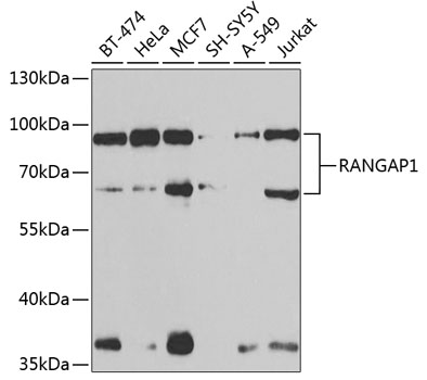 Western blot - RANGAP1 Polyclonal Antibody 