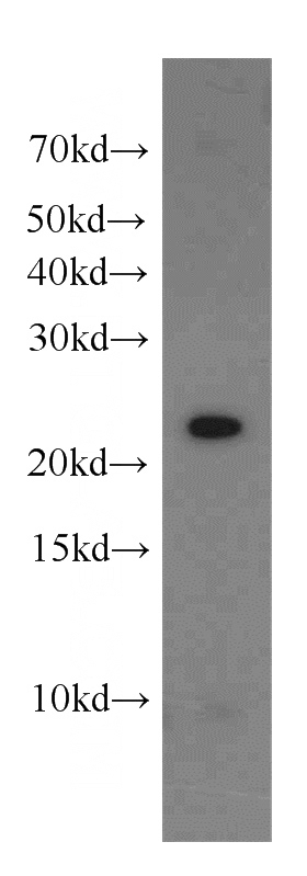 K-562 cells were subjected to SDS PAGE followed by western blot with Catalog No:109106(CDC42EP2 antibody) at dilution of 1:200