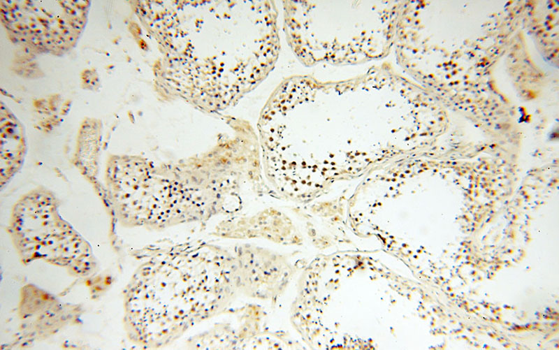 Immunohistochemical of paraffin-embedded human testis using Catalog No:115957(TEX12 antibody) at dilution of 1:100 (under 10x lens)