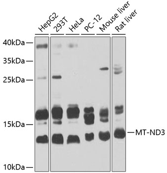 Western blot - MT-ND3 Polyclonal Antibody 