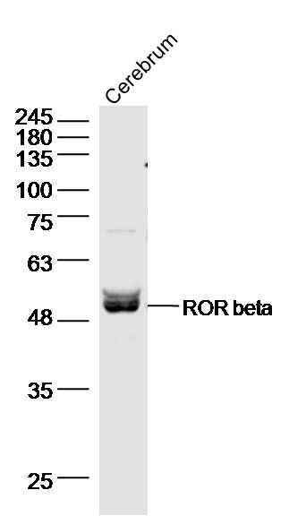 Fig1: Sample:; cerebum (Mouse) Lysate at 40 ug; Primary: Anti- ROR beta at 1/500 dilution; Secondary: IRDye800CW Goat Anti-Rabbit IgG at 1/20000 dilution; Predicted band size: 53 kD; Observed band size: 53 kD