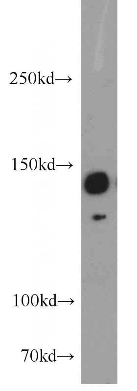HeLa cells were subjected to SDS PAGE followed by western blot with Catalog No:117236(BRIP1 antibody) at dilution of 1:1000