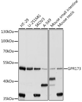 Western blot - GPR173 Polyclonal Antibody 