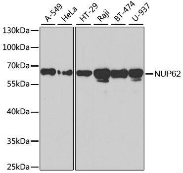 Western blot - NUP62 Polyclonal Antibody 