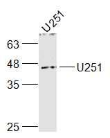 Fig2: Sample:; U251(Human) Cell Lysate at 30 ug; Primary: Anti-GPR4 at 1/1000 dilution; Secondary: IRDye800CW Goat Anti-Rabbit IgG at 1/20000 dilution; Predicted band size: 41 kD; Observed band size: 43 kD