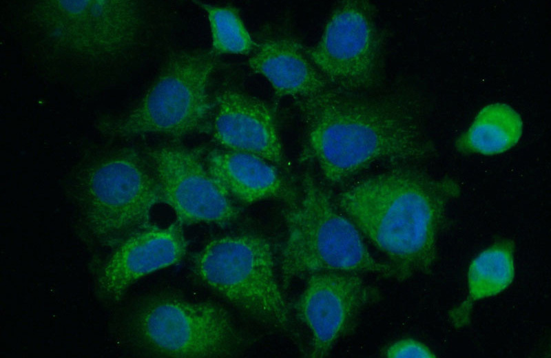 Immunofluorescent analysis of MCF-7 cells using Catalog No:107730(ACBD4 Antibody) at dilution of 1:50 and Alexa Fluor 488-congugated AffiniPure Goat Anti-Rabbit IgG(H+L)