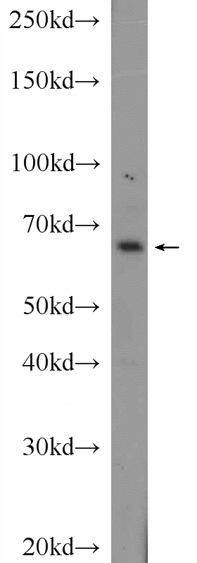 mouse kidney tissue were subjected to SDS PAGE followed by western blot with Catalog No:109648(CXorf15 Antibody) at dilution of 1:1000