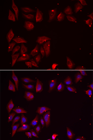 Immunofluorescence - PDXK Polyclonal Antibody 