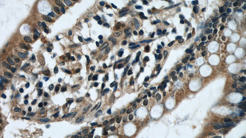 Immunohistochemical of paraffin-embedded human small intestine using Catalog No:115487(SOAT2 antibody) at dilution of 1:50 (under 40x lens)