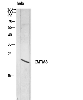 Fig1:; Western blot analysis of hela lysis using CMTM8 antibody.. Secondary antibody（catalog#：HA1001) was diluted at 1:20000