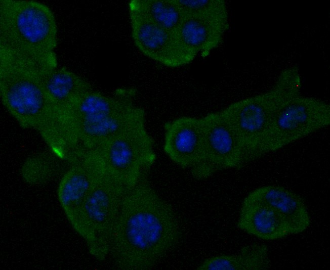 Fig1: ICC staining Alpha-2-macroglobulin in H22 cells (green). Formalin fixed cells were permeabilized with 0.1% Triton X-100 in TBS for 10 minutes at room temperature and blocked with 1% Blocker BSA for 15 minutes at room temperature. Cells were probed with Alpha-2-macroglobulin monoclonal antibody at a dilution of 1:50 for at least 1 hour at room temperature, washed with PBS. Alexa Fluorc™ 488 Goat anti-Mouse IgG was used as the secondary antibody at 1/100 dilution. The nuclear counter stain is DAPI (blue).