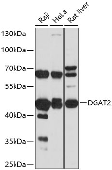 Western blot - DGAT2 Polyclonal Antibody 