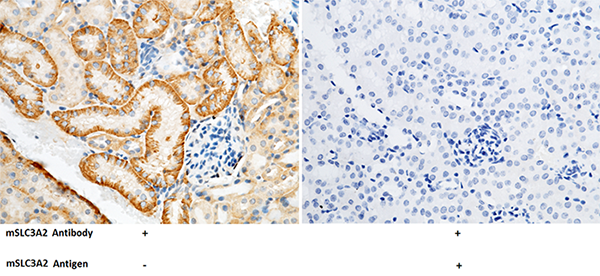 SLC3A2 / CD98 Antibody, Rabbit PAb, Antigen Affinity Purified, Immunohistochemistry