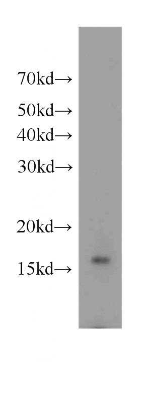 mouse cerebellum tissue were subjected to SDS PAGE followed by western blot with Catalog No:110673(FKBP2 antibody) at dilution of 1:500