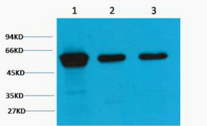 Western blot analysis of 1) Hela, 2) Mouse Brain Tissue, 3) Rat Brain tissue, diluted at 1:2000.