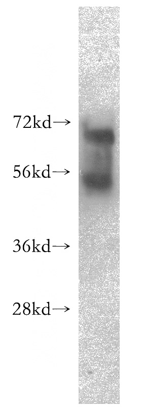 HEK-293 cells were subjected to SDS PAGE followed by western blot with Catalog No:112092(KLHL14 antibody) at dilution of 1:1000