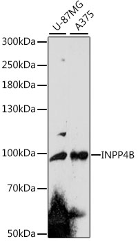 Western blot - INPP4B Polyclonal Antibody 