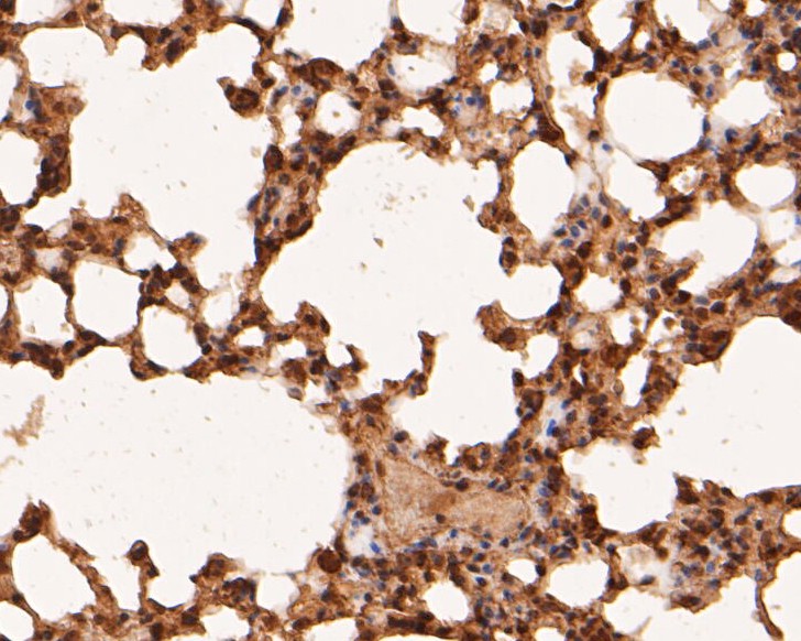 Fig6: Immunohistochemical analysis of paraffin-embedded mouse lung tissue using anti-RBPMS antibody. The section was pre-treated using heat mediated antigen retrieval with sodium citrate buffer (pH 6.0) for 20 minutes. The tissues were blocked in 5% BSA for 30 minutes at room temperature, washed with ddH2O and PBS, and then probed with the primary antibody ( 1/50) for 30 minutes at room temperature. The detection was performed using an HRP conjugated compact polymer system. DAB was used as the chromogen. Tissues were counterstained with hematoxylin and mounted with DPX.