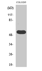 Fig1:; Western Blot analysis of various cells using LPD lipase Polyclonal Antibody