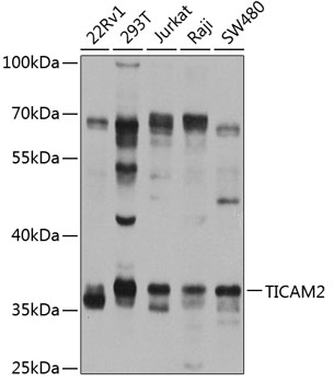 Western blot - TICAM2 Polyclonal Antibody 