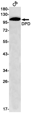 Western blot detection of DPD in C6 cell lysates using DPD Rabbit pAb(1:1000 diluted).Predicted band size:111kDa.Observed band size:111kDa.