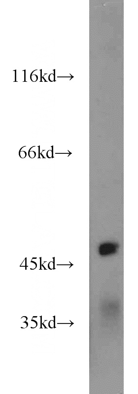 mouse brain tissue were subjected to SDS PAGE followed by western blot with Catalog No:111635(IGSF21 antibody) at dilution of 1:1000