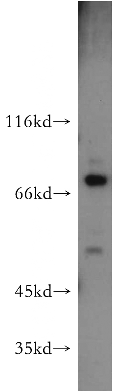 mouse kidney tissue were subjected to SDS PAGE followed by western blot with Catalog No:108631(C1orf106 antibody) at dilution of 1:300