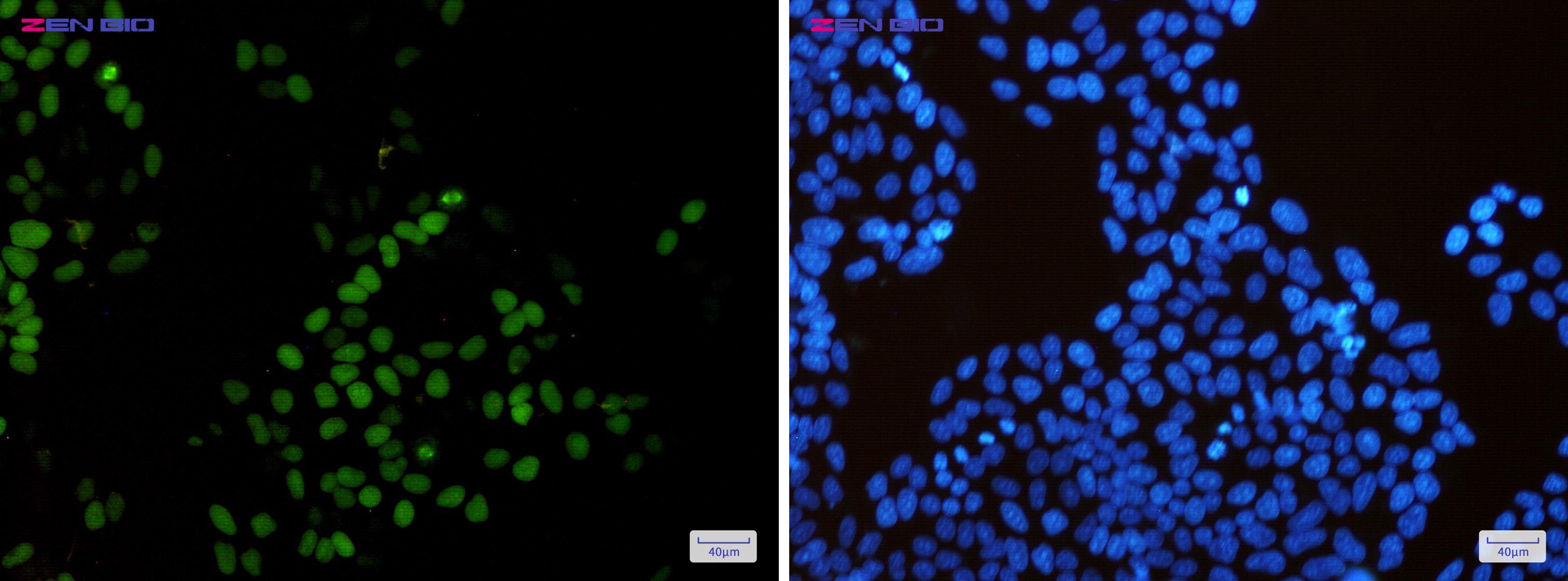 Immunocytochemistry of KIFC1(green) in Hela cells using KIFC1 Rabbit mAb at dilution 1/50, and DAPI(blue)