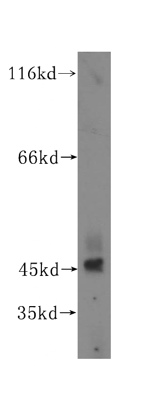 human testis tissue were subjected to SDS PAGE followed by western blot with Catalog No:115993(TEX28 antibody) at dilution of 1:500