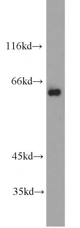 HEK-293 cells were subjected to SDS PAGE followed by western blot with Catalog No:114772(RNPS1 antibody) at dilution of 1:1000