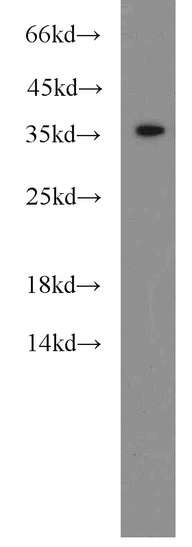 HEK-293 cells were subjected to SDS PAGE followed by western blot with Catalog No:111715(HTRA2 antibody) at dilution of 1:2000