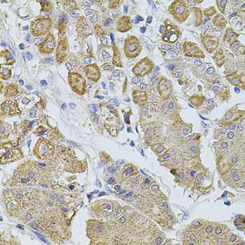 Immunohistochemistry - TRPA1 Polyclonal Antibody 